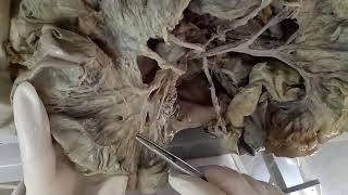 INTESTINES  BY DR MITESH DAVE [upl. by Attekram]