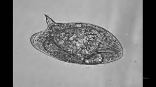 Schistosoma mansoni egg demonstration Marwa Omar [upl. by Popper]