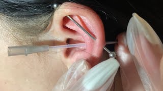 close up conch piercing at home [upl. by Drahsar]