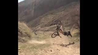 LOST TEETH Mountain bike fail [upl. by Araj409]