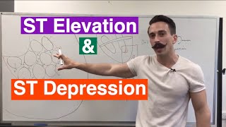 ST Elevation and ST Depression EXPLAINED [upl. by Gnourt194]