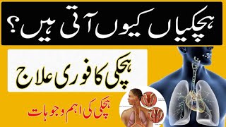 Hichki kaise band kare  Hiccups ka ilaj in urduhindi  Hiccups Treatment  हिचकी Dr Zubair baloch [upl. by Nicks909]