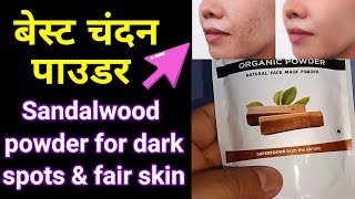 Best Sandalwood Face Pack For glowing skin  Chandan Powder Face Pack For Glowing Fair Skin [upl. by Aissak376]