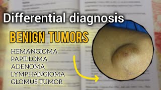 Diagnosis of swelling  Benign tumor  clinical surgery examination [upl. by Asena]