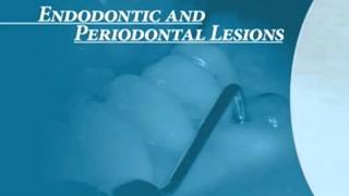 Endodontics Torabinejad 60 Endo Perio Introduction [upl. by Elleoj442]