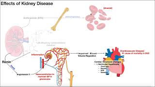 Chronic Kidney Disease EXPLAINED Pathogenesis Effects amp Staging [upl. by Atikan]