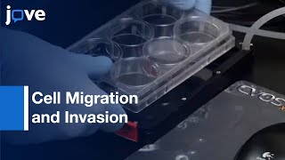 Cell Migration and Invasion [upl. by Heall]