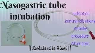 NG nasogastric Intubation procedure Article  explained in Hindi [upl. by Alisha]