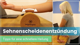 Sehnenscheidenentzündung  Ursachen  6 Tipps  2 schnelle Übungen [upl. by Ianahs806]