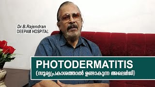 PHOTODERMATITIS  MEDI TALK  DR B RAJENDRAN  DEEPAM HOSPITAL [upl. by Rosanne78]