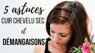 ⚠CUIR CHEVELU SEC démangeaisons et pellicules  5 conseils soins [upl. by Lyns]