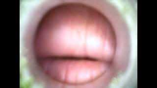 LipCam Trompete Haydn wwwlipcamde [upl. by Ahserkal248]