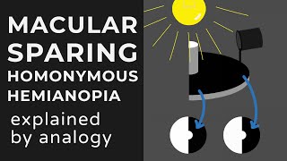 Macular Sparing amp Splitting Homonymous Hemianopia  Animation  Explained Conceptually [upl. by Esinej]