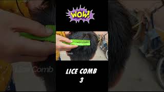 Removal Big Lice Part5 licecomb short [upl. by Augustine]