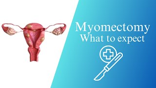 Myomectomy explained What to expect [upl. by Ennobe]