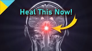 Strong PITUITARY GLAND Healing Tone ❯❯❯ 10500 Hz • Quantum Miracle Formula Frequency [upl. by Annalise]