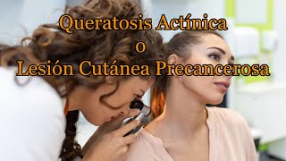 Queratosis Actínica o Lesión Cutánea Precancerosa [upl. by Keviv]