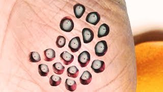 Trypophobia Trypophobia Trypophobia [upl. by Trask]