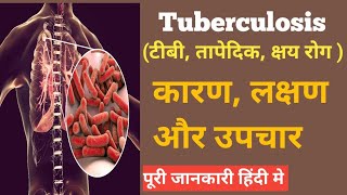 Tuberculosis टीबी तापेदिक क्षय रोग  क्यों होता है कारण लक्षण और बचाव   In hindi [upl. by Karney296]