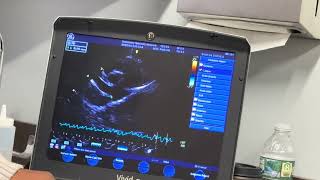 Learn about Echocardiogram for puppy with pda [upl. by Kylila]