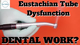 Eustachian Tube Dysfunction and Needing Dental Work The Root Cause Personal Experience [upl. by Nairad]