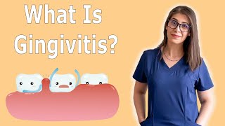 What Is Gingivitis  How To Treat Gingivitis [upl. by Lynn]