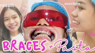 I GOT BRACES vlog at Denta Care Philippines  love jella ♡ [upl. by Aillil]