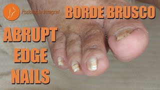 Abrupt edge nails podology asmr [upl. by Reave836]