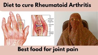 how to cure Rheumatoid Arthritis with diet  diet for joint pain [upl. by Eddina427]