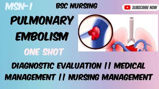 Pulmonary embolism part 2 [upl. by Nason566]