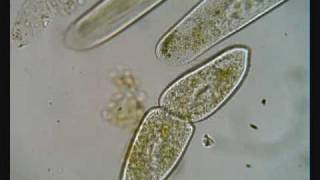 Paramecium Dividing [upl. by Sahcnip]