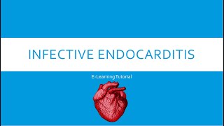 Infective Endocarditis [upl. by Gievlos]