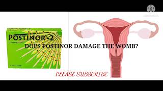 Can postinor 2 damage the womb uterus [upl. by Ainoda]