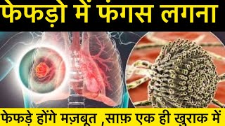 Lungs fungal infection फेफड़ो में फ़ंगस जमने लगे तो क्या करे how to detox lungs in naturally [upl. by Nerrag]