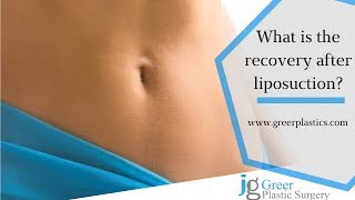 How long will you need off work after lipo [upl. by Marven]