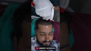 Hair wash After Hair Transplant At Shobhit Aesthetics [upl. by Milly]