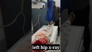 left hip xray youtuber facts doctor youtubeshort [upl. by Tiphane620]