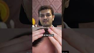 Receding Hairline Causes hairline recedinghairline hairtransplant hairtutorial shorts [upl. by Nalyr302]