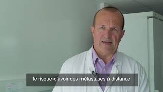 ASCO 2018  radiothérapie et cancers du sein [upl. by Sullivan]