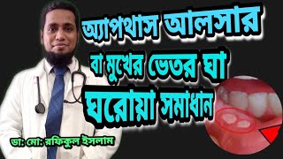 অ‌্যাপথাস আলসার এর ঘ‌রোয়া সমাধান  Aphthous ulcer in Bangla [upl. by Furlani]