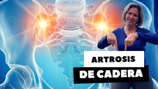 ARTROSIS DE CADERA PARTE 1 [upl. by Aydiv201]