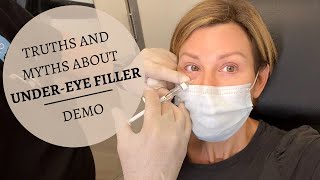 UNDER EYE FILLERS Before amp After  Restylane Results Truths amp MYTHS  Dominique Sachse [upl. by Blatman]