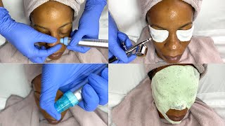 Hydrodermabrasion Facial with Oxygen Infusion Treatment [upl. by Kemppe]