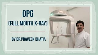 OPG  ORTHOPANTOMOGRAM FULL MOUTH XRAY  ओ पी जी  BY DRPraveen Bhatia [upl. by Alger529]