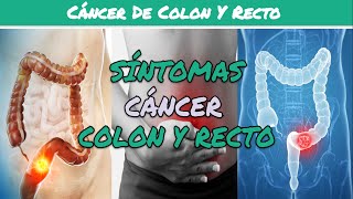 ⚕️🩺 6 SÍNTOMAS de CÁNCER DE COLON Y RECTO Síntomas Diagnóstico y Tratamiento [upl. by Aneeh]