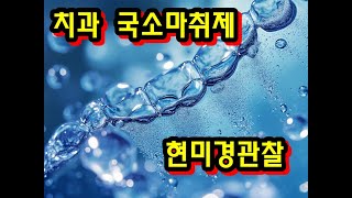 치과 국소마취제를 현미경으로 보았다 [upl. by Suki]