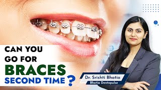 Can you Get BRACES a SECOND Time Dr Srishti Bhatia braces bracessmile smilemakeover [upl. by Fry]