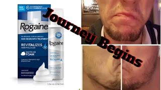 Minoxidil Beard  Minoxidil 5 for Beard Growth  The Journey Begins  FacialFuzzFridays [upl. by Ries]