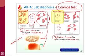 Hematology  2  U1L11  Coombs test [upl. by Nesilla]