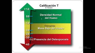 DENSITOMETRIA OSEA [upl. by Yram681]